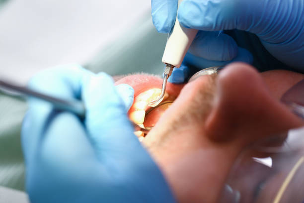 Best Emergency Treatment for Toothache in Westgate, FL